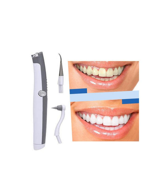 Electric Ultrasonic Tooth Stain Eraser – dinoinbox